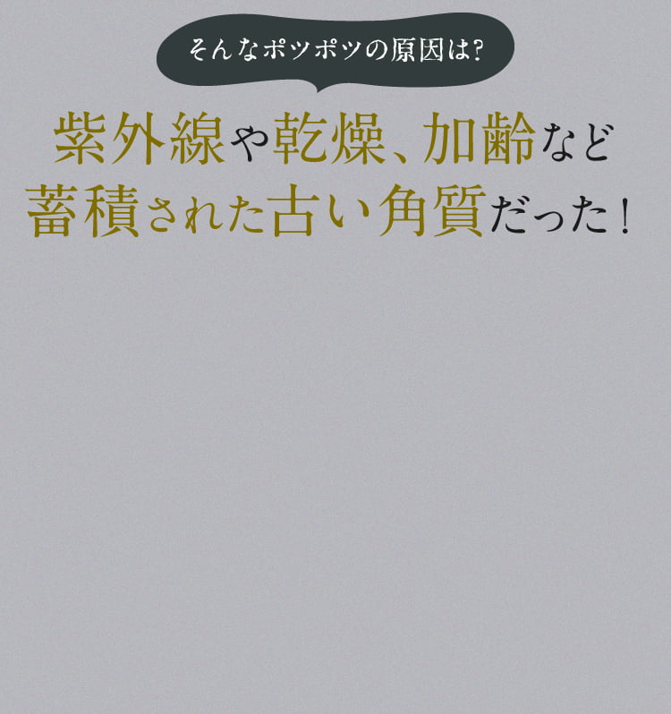 紫外線や乾燥、加齢など蓄積された古い角質だった！