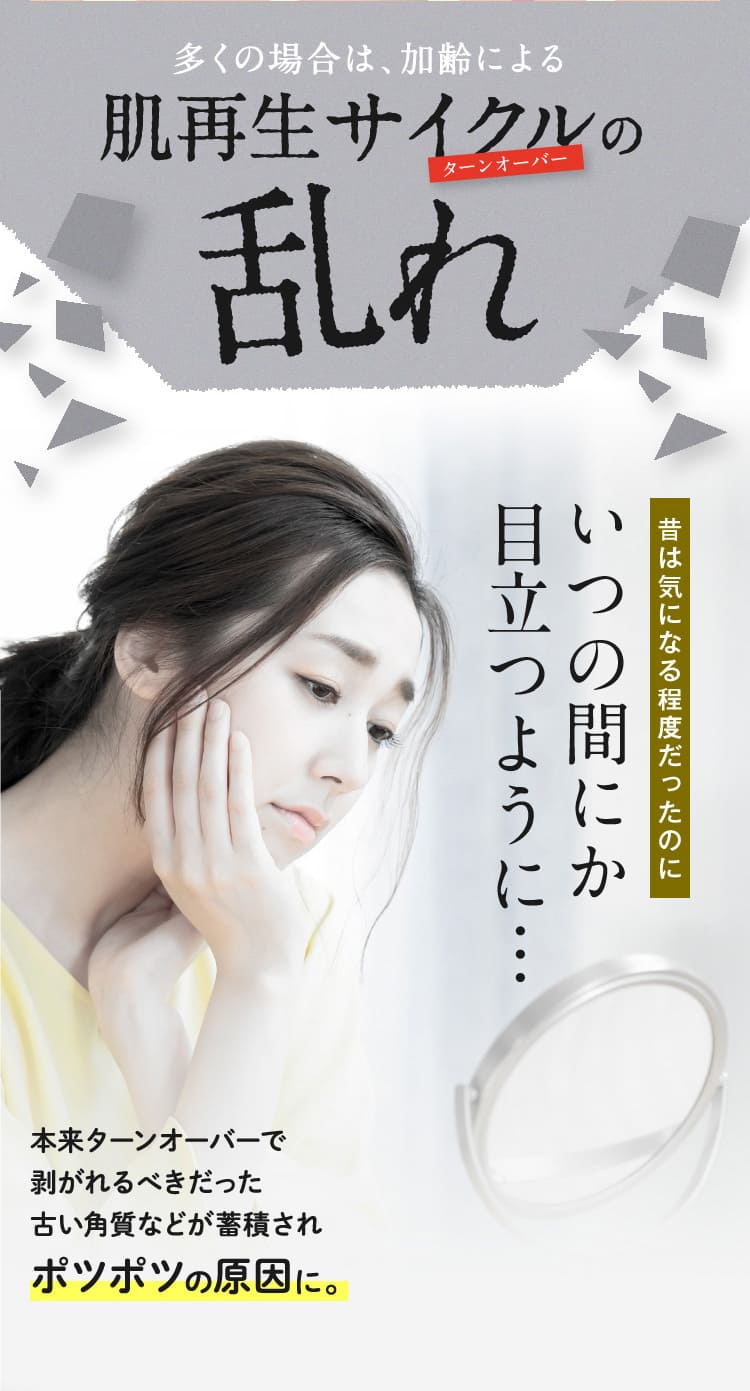 昔は気になる程度だったのにいつの間にか
目立つように…